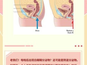 生殖出现白色泥状怎么办？专家解答常见原因及有效处理方法