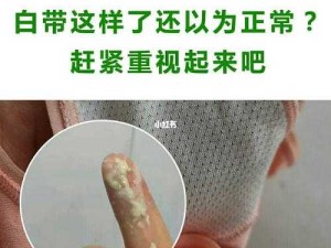 女生流出白白的东西是怎么回事：白带异常可能是这些原因导致的