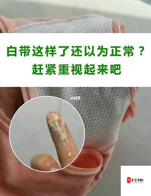 女生流出白白的东西是怎么回事：白带异常可能是这些原因导致的