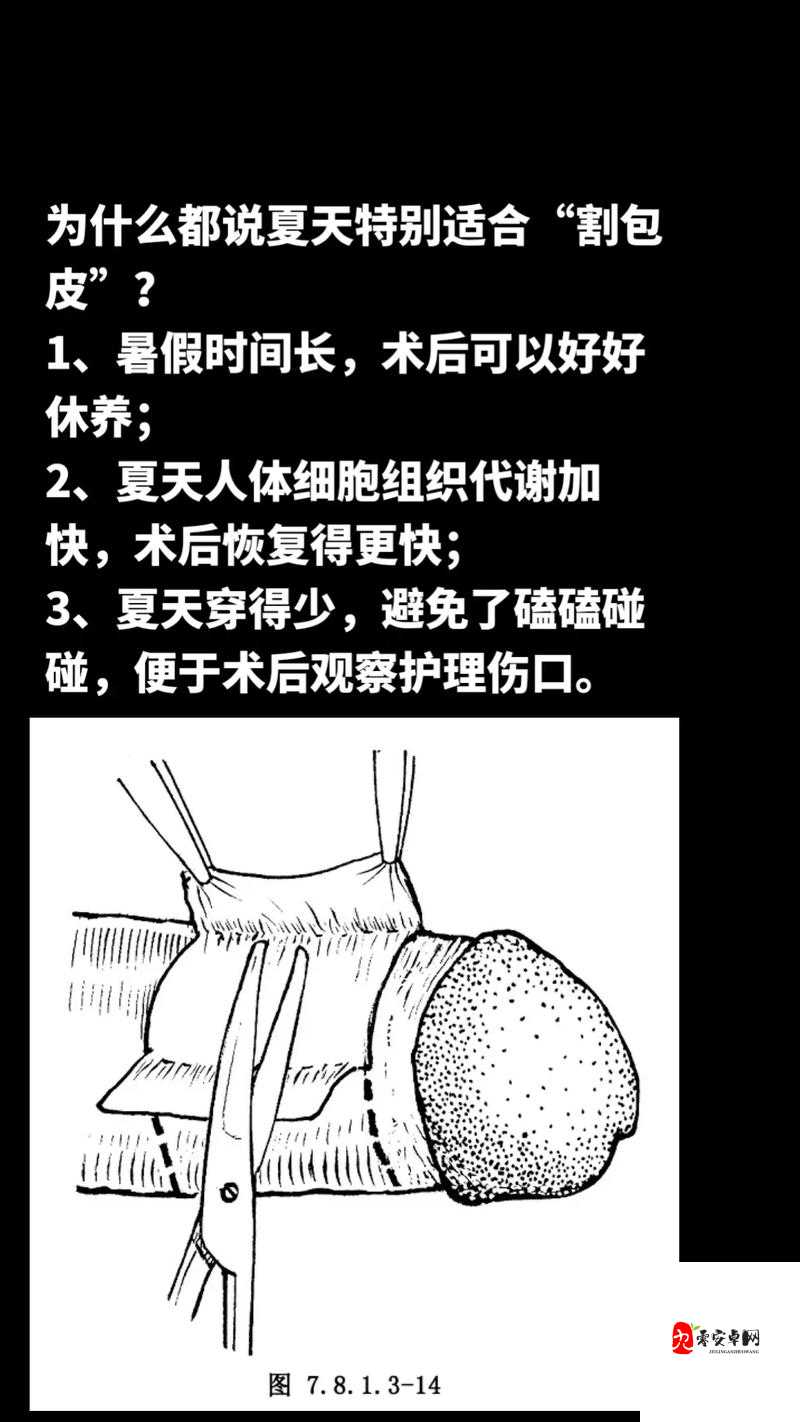 男人割了皮包什么样子要手举着呢：术后恢复的注意事项