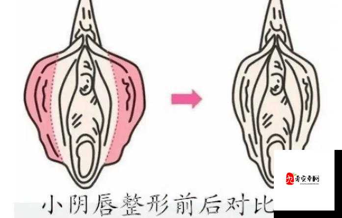 女性三角毛毛区长了个硬疙瘩：探寻其背后的健康隐忧